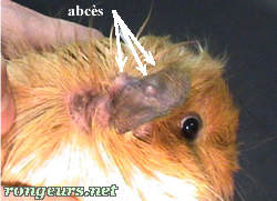 Abces de morsure